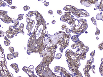 Collagen IV COL4A1 Antibody (monoclonal, 3G3)