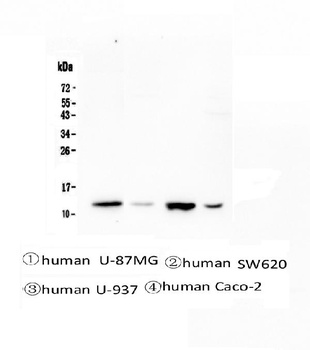Stefin B CSTB Antibody (monoclonal, 2B6)