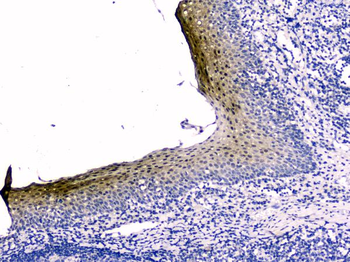 Anti-Stefin B CSTB Antibody (monoclonal, 2B6)