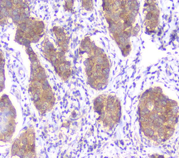 Anti-SMN1/2 Antibody (monoclonal, 2B10)