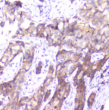 Anti-SMN1/2 Antibody (monoclonal, 2B10)