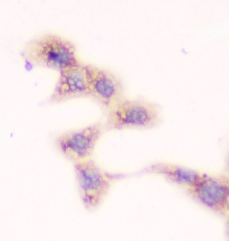 SMN1/2 Antibody (monoclonal, 2B10)