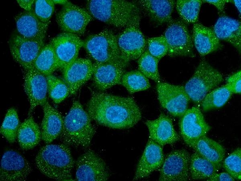 CCT3 Mouse Monoclonal Antibody