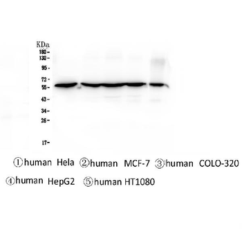 CCT3 Mouse Monoclonal Antibody