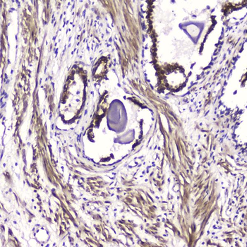Anti-ATF4 Antibody