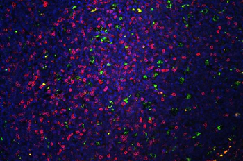 Anti-CD5 Antibody