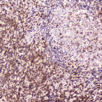 Anti-CD5 Antibody