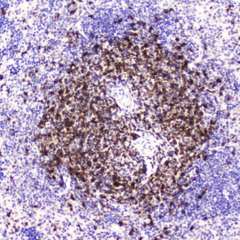Anti-CD5 Antibody