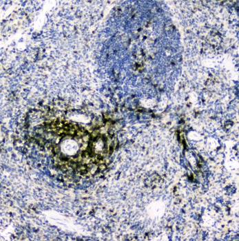 Anti-CD5 Antibody