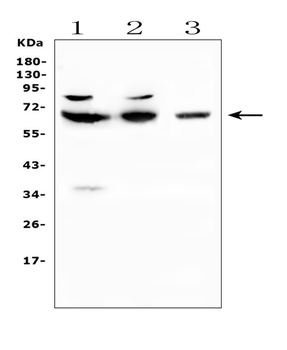 Anti-CD5 Antibody