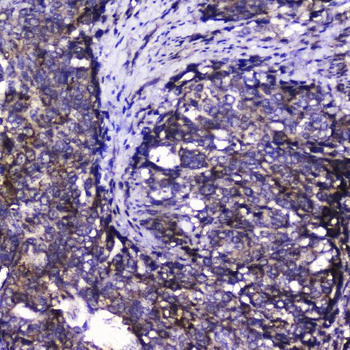 Cdk6 Rabbit Polyclonal Antibody