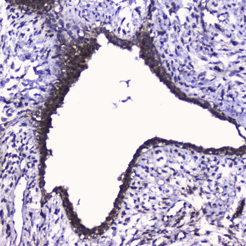 Anti-Cdk6 Antibody