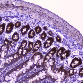 Anti-FLIP/CFLAR Antibody