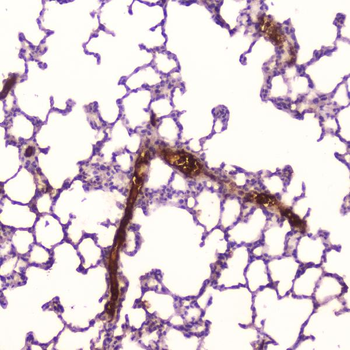 Anti-C Reactive Protein/Crp Antibody