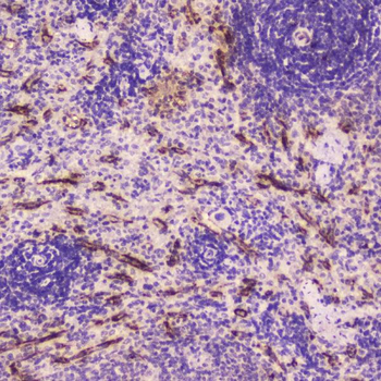 Anti-C Reactive Protein/Crp Antibody