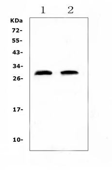 Anti-C Reactive Protein/Crp Antibody
