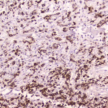 Cathepsin E/CTSE Antibody