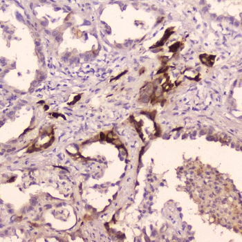 Cathepsin E/CTSE Antibody