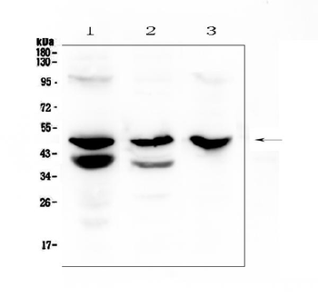 Cathepsin E/CTSE Antibody