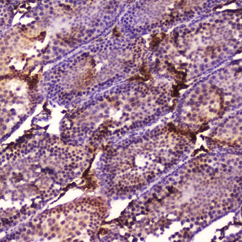 Anti-Cytochrome P450 17A1/Cyp17a1 Antibody