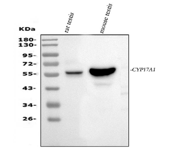 Anti-Cytochrome P450 17A1/Cyp17a1 Antibody
