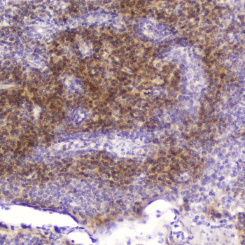 Anti-Cardiac FABP/FABP3 Antibody