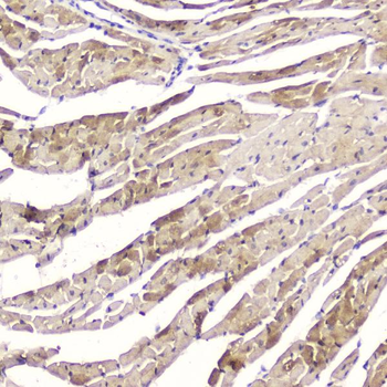 Anti-Cardiac FABP/FABP3 Antibody
