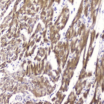 Cardiac FABP/FABP3 Antibody