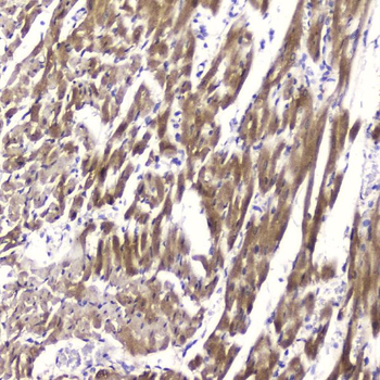 Anti-Cardiac FABP/FABP3 Antibody