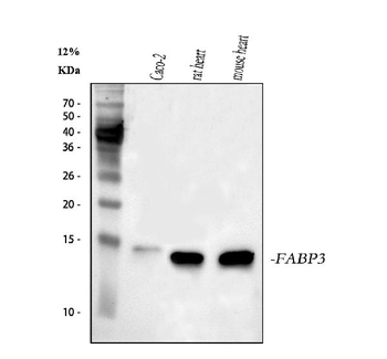 Anti-Cardiac FABP/FABP3 Antibody