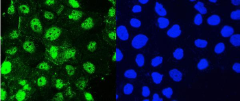 Anti-Hsp105/HSPH1 Antibody