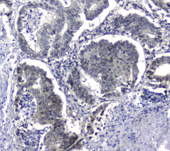 Anti-Hsp105/HSPH1 Antibody