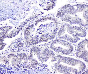 Anti-Hsp105/HSPH1 Antibody