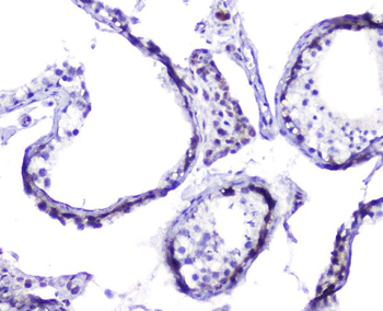 Anti-Hsp105/HSPH1 Antibody
