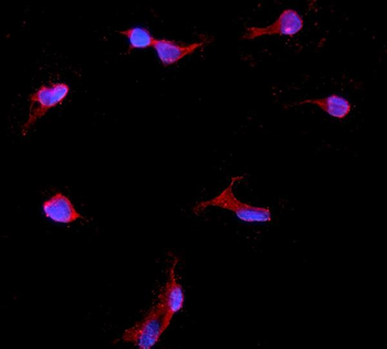 Anti-IGFBP2 Antibody