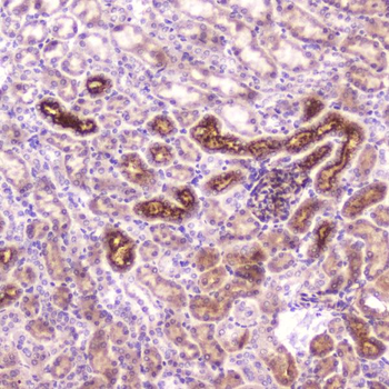 Anti-IGFBP2 Antibody