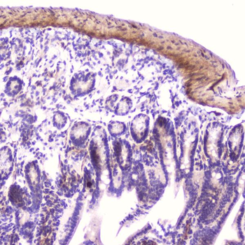 Anti-IGFBP2 Antibody