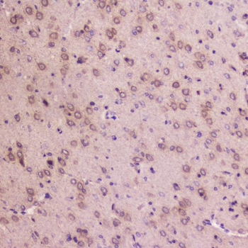 Anti-IGFBP2 Antibody