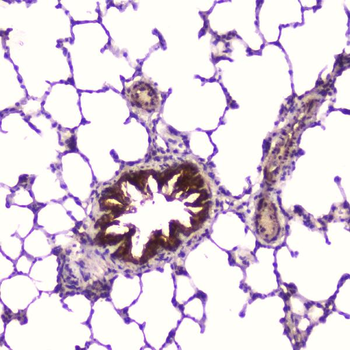 Anti-IGFBP2 Antibody