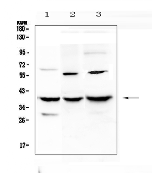 Anti-IGFBP2 Antibody