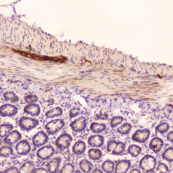 Anti-ANP/Nppa Antibody