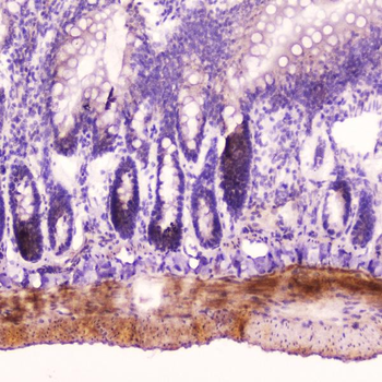 Anti-ANP/Nppa Antibody