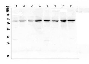NF-kB p65/RELA Antibody