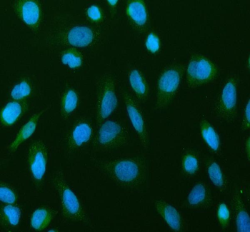 Anti-NF-kB p65/RELA Antibody