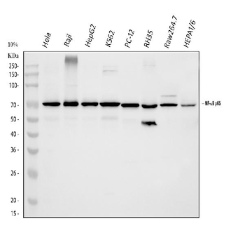 Anti-NF-kB p65/RELA Antibody