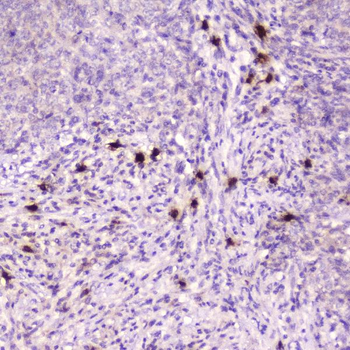 Anti-Ribonuclease 3/RNASE3 Antibody