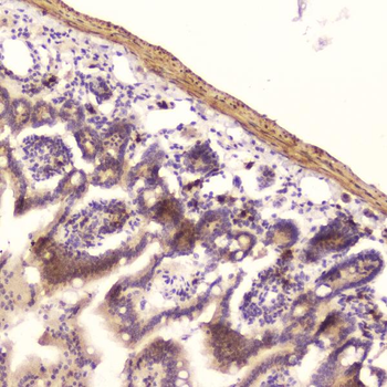 Anti-Ribonuclease 3/RNASE3 Antibody