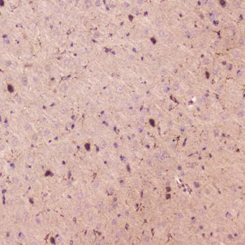 Anti-SPARCL1 Antibody