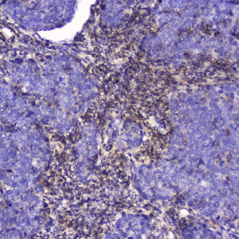 Anti-Talin 1/TLN1 Antibody