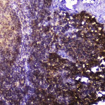 Anti-Talin 1/TLN1 Antibody